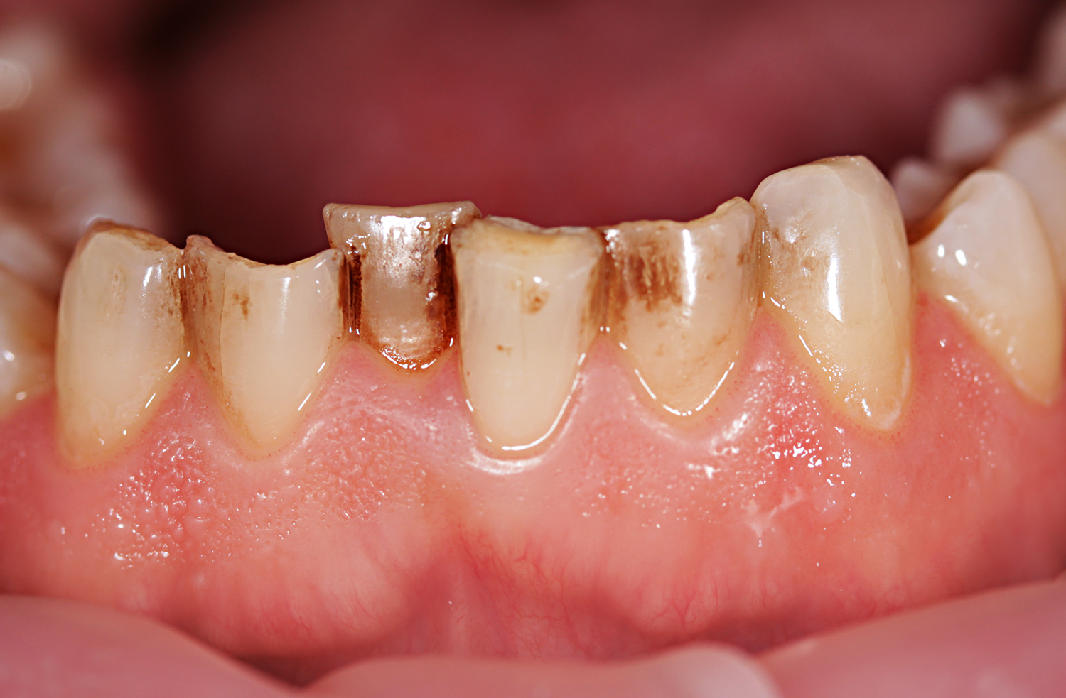 Какой стоматолог что лечит? Полезная информация для пациентов клиники Smile-at-Once